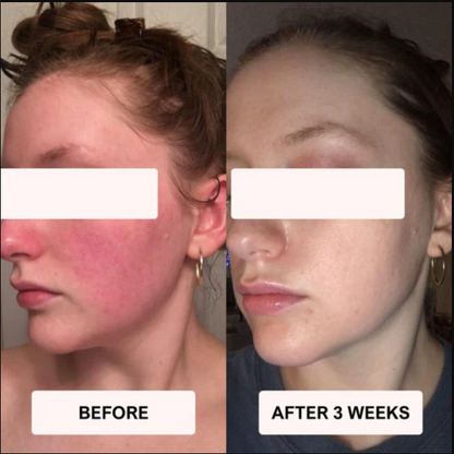 VELOURA RegenMask™