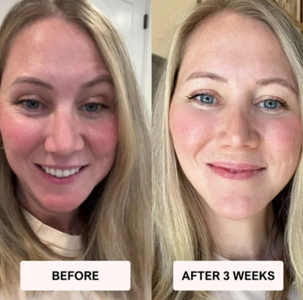 VELOURA RegenMask™